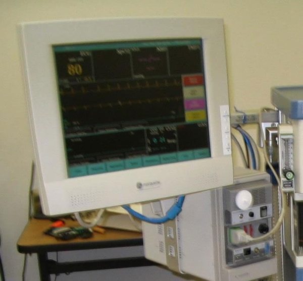 GE Solar 9500 Anestesia / Monitor de Paciente - reacondicionado