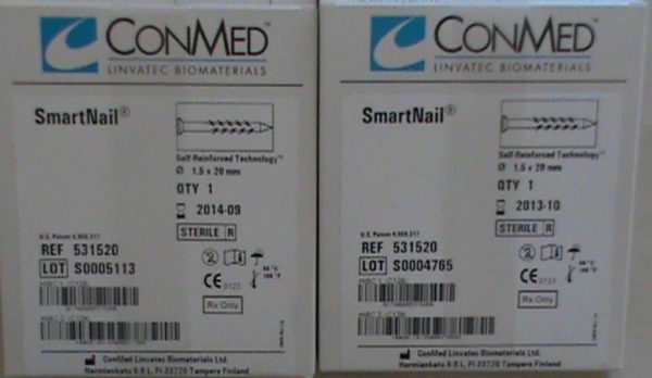 531520 Conmed Linvatec Smartnail